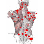 Fibromialgia: a doença invisível que atinge mais as mulheres