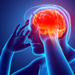 Aneurisma cerebral: saiba mais sobre essa doença, que pode ser silenciosa